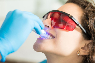 Blanqueamiento Dental