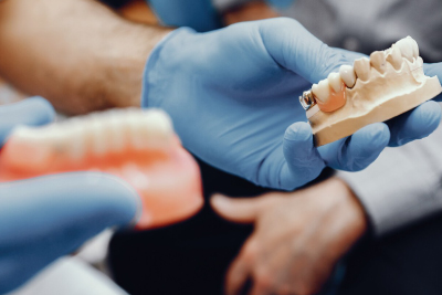 Prótesis Dental